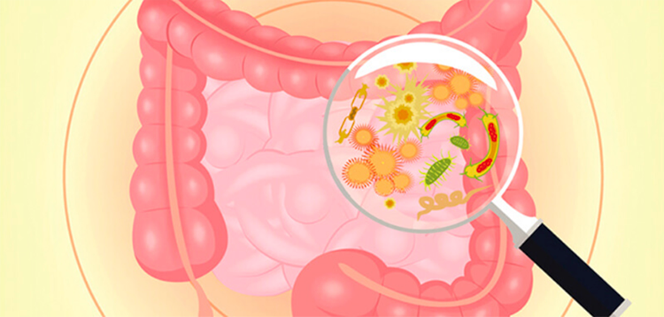 danielleal-sindrome-ovario-poliquistico-flora-intestinal